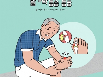 바람만 스쳐도 아픈 ‘통풍’