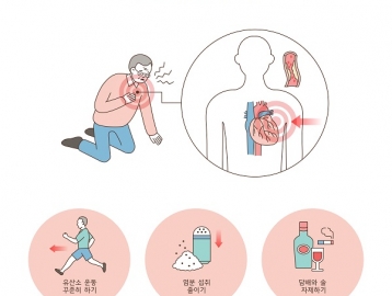 심근경색증, 얼마나 알고 계신가요?